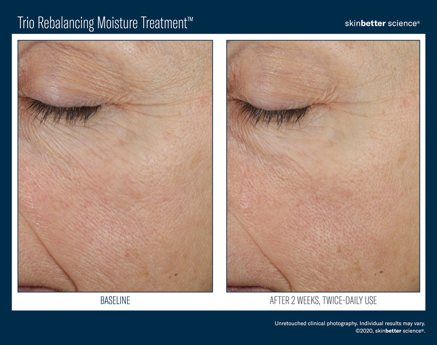 Skinbetter Trio Rebalancing Moisture Treatment