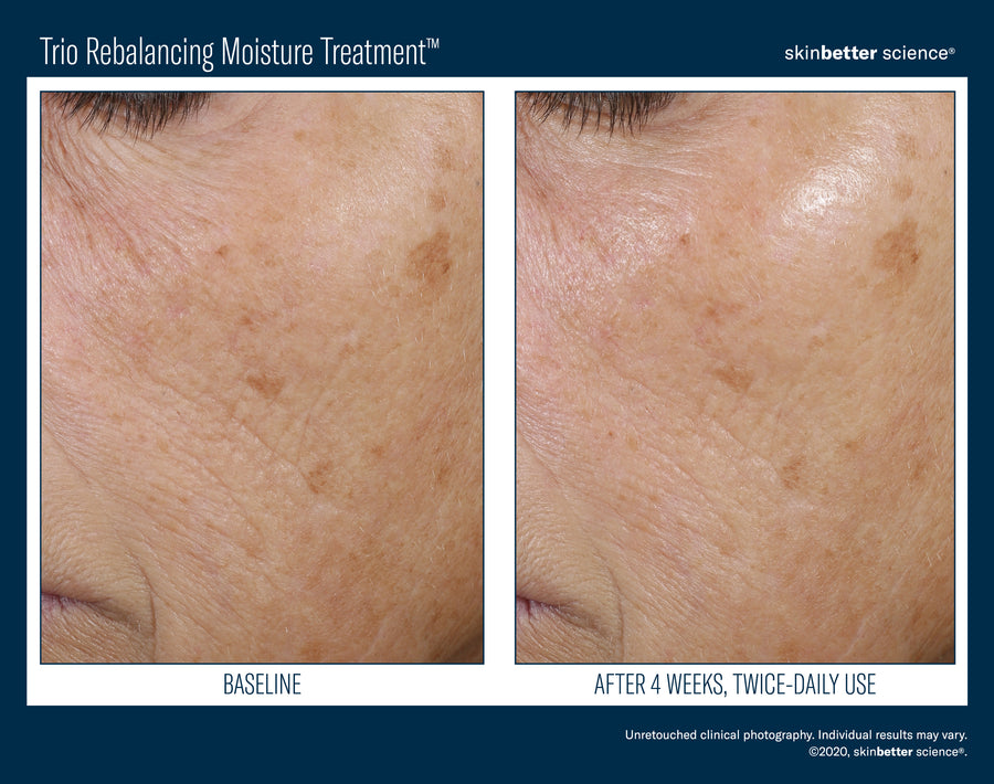 Skinbetter Trio Rebalancing Moisture Treatment