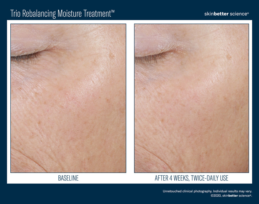Skinbetter Trio Rebalancing Moisture Treatment