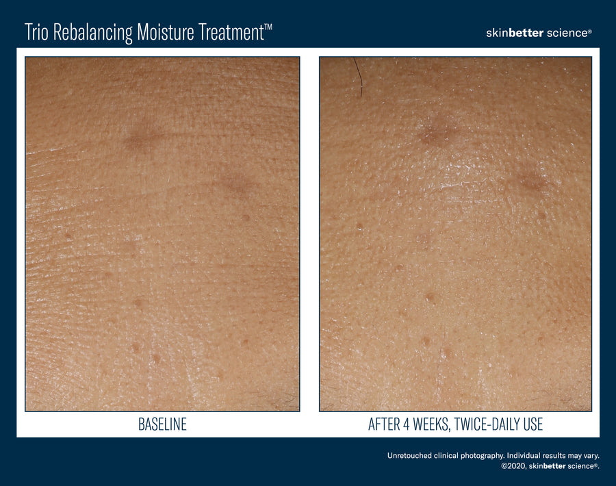 Skinbetter Trio Rebalancing Moisture Treatment