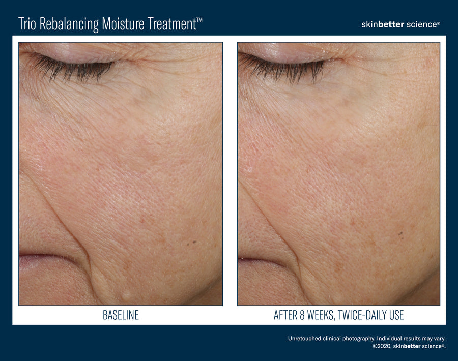 Skinbetter Trio Rebalancing Moisture Treatment