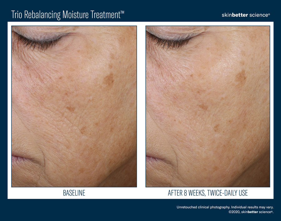Skinbetter Trio Rebalancing Moisture Treatment
